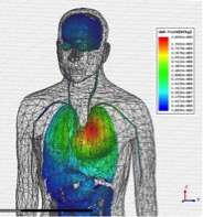 Local Specific Absorption Rate (SAR) distribution on upper side of male body model.